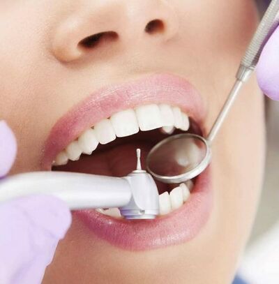 Dentista specchio 503x512
